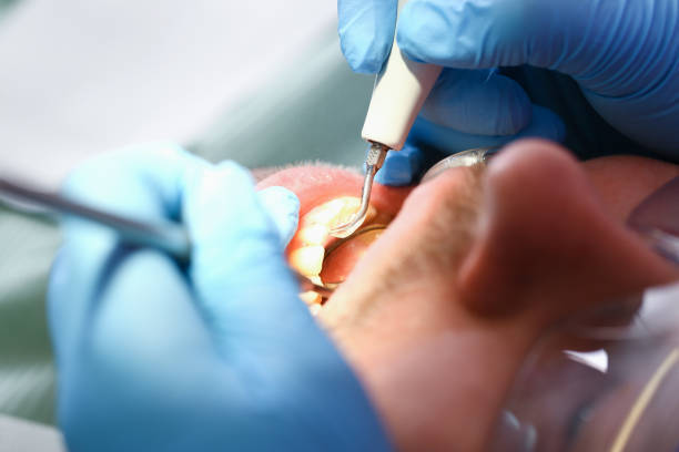 Best Emergency Dentist for Knocked-Out Tooth in New Freedom, PA